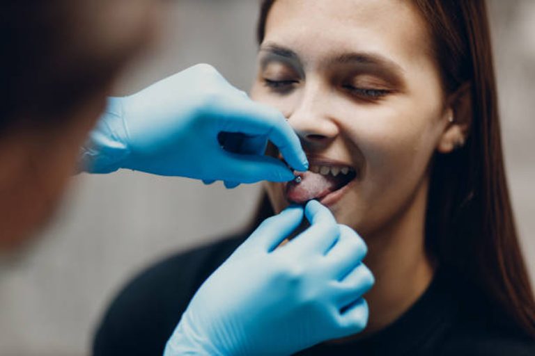 Comment Dévisser un Piercing Trop Serré Astuces et « Conseils Essentiels Magazine Tarawa