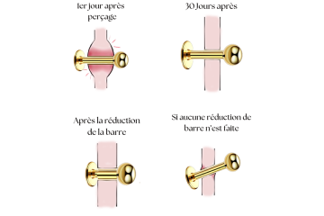 Le Downsizing Piercing : une étape clé pour une cicatrisation réussie